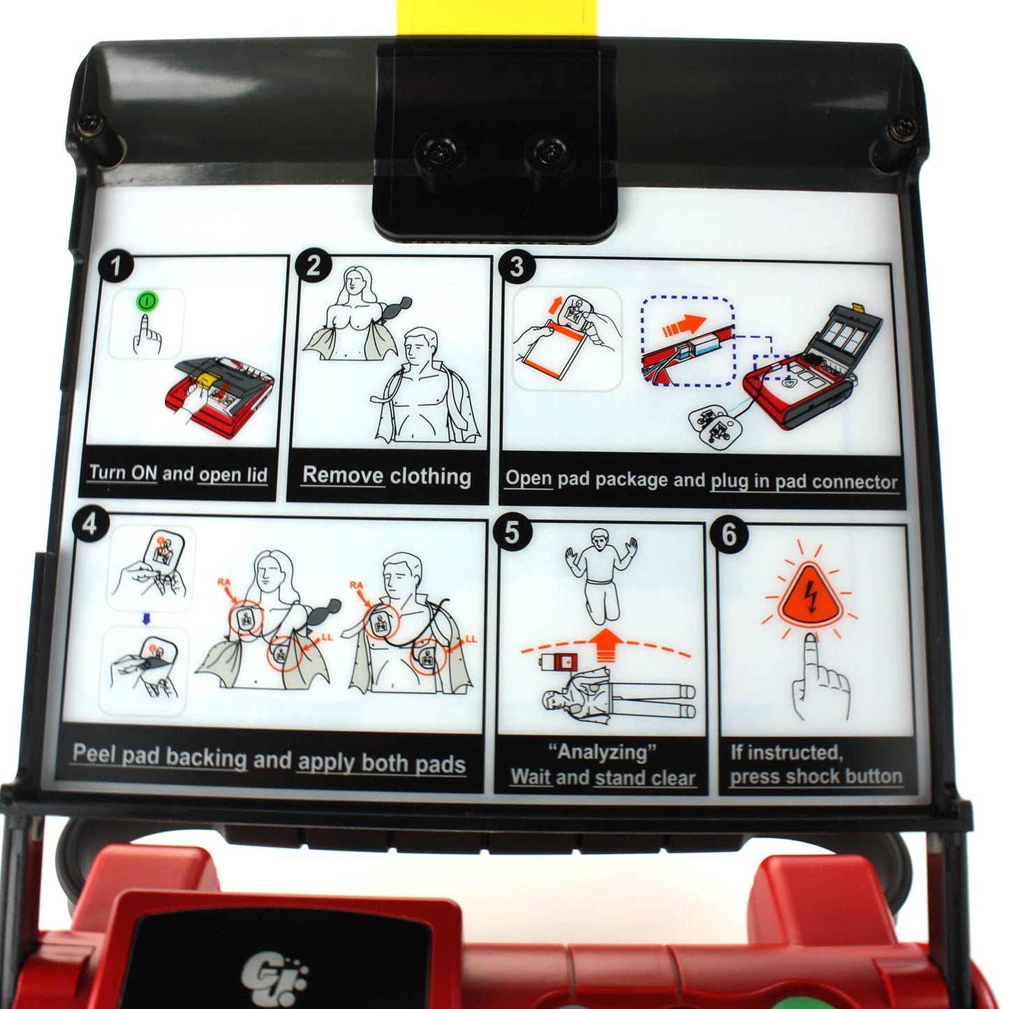 iPAD Saver NF1200 Semi Automatic Defibrillator with Adult Pads - AED